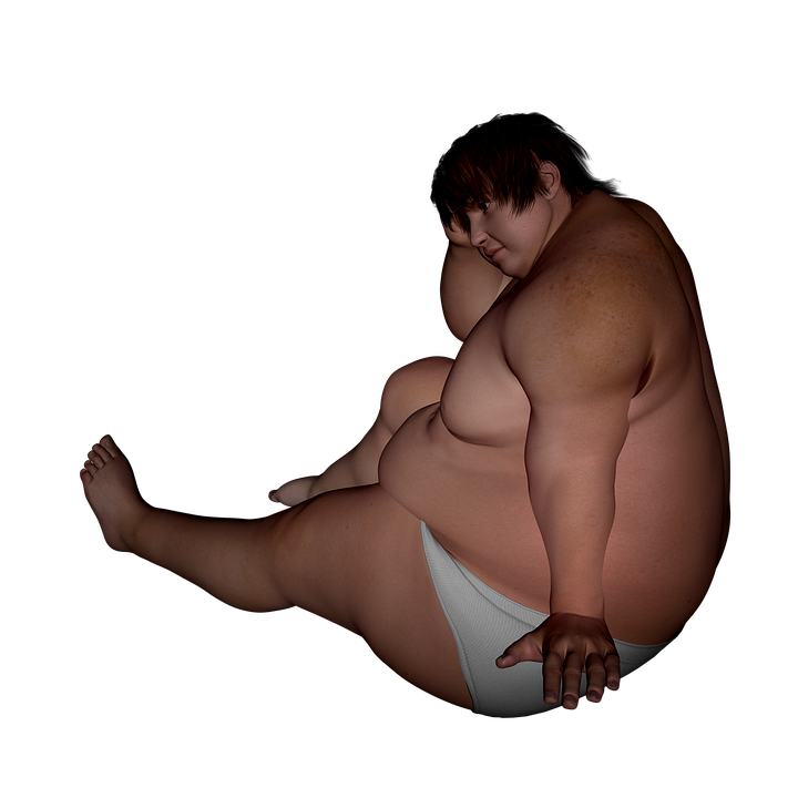 obese woman