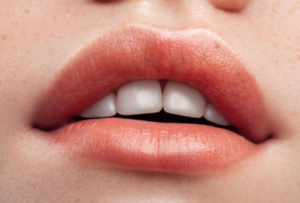 Dental Health