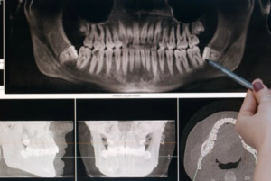 teeth